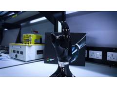 
      
      Hyderabad’s bionic hands: Restoring lives, rebuilding confidence
      
      
