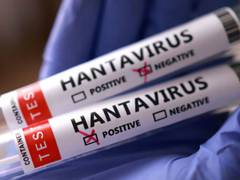 
      
      Health Ministry activates surveillance amid Hantavirus cases
      
      