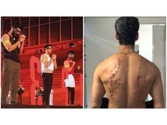 
      
      KKK 15: Gaurav Khanna, Karan Wahi shares injury marks from stunt
      
      