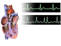 
      
      Home-based education reduces hospitalizations of atrial...
      
      