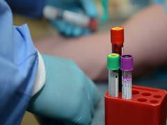 
      
      In a first, AIIMS extends blood sample collection timing
      
      
