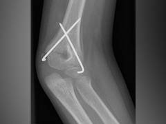 
      
      New target therapy to protect bones during ageing found...
      
      