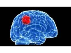 
      
      Blocking fat storage might offer new way to treat most lethal...
      
      