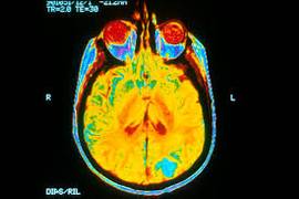 
      
      New treatments on horizon for treating devastating brain...
      
      