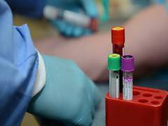 
      
      Downward trend in new COVID cases in India continues,...
      
      