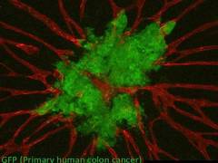 
      
      Scientists discover new technique depicting cancer cells...
      
      