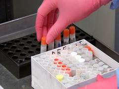 
      
      Four more test positive for COVID-19 in Buldhana, district...
      
      