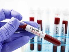 
      
      Andhra Pradesh records 753 new COVID-19 cases, 13 deaths
      
      