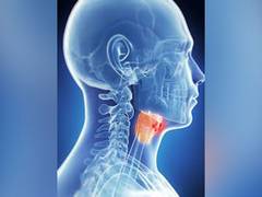 
      
      New technique can predict complications after larynx cancer...
      
      