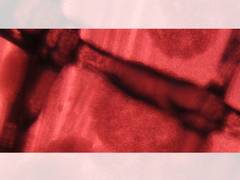 
      
      Cell therapy options at Guang-Li Biomedicine and Taipei...
      
      