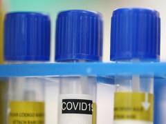 
      
      2 MP Health Dept officials test positive for COVID-19
      
      
