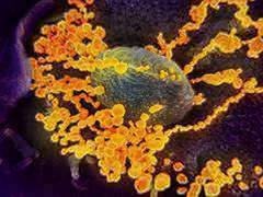 
      
      241 isolation wards created in Uttarakhand amid coronavirus...
      
      