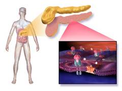 
      
      Scaling down carbohydrate consumption revamps type 2...
      
      