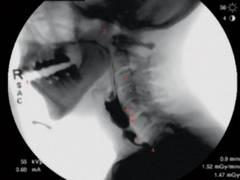 
      
      Research shows new guidelines set to standardize swallowing fluor
      
      