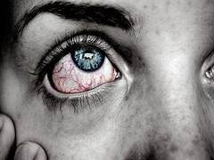 
      
      New test developed to help prevent glaucoma-related blindness 
      
      