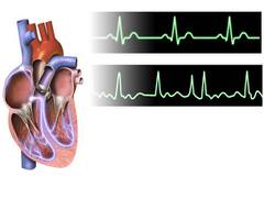 
      
      Study defines how to assess quality of care for patients with...
      
      