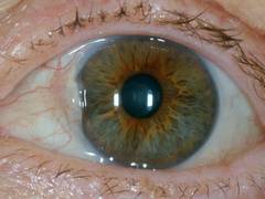 
      
      Artificial intelligence can accurately detect diabetic eye
      
      