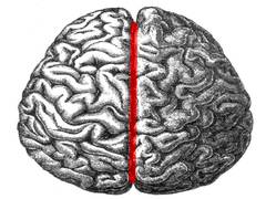 
      
      Autistic people have symmetrical brain hemispheres: Study
      
      