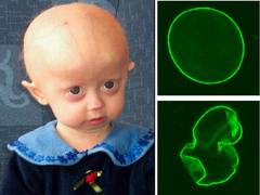 
      
      Researchers discover possible new treatment strategy against...
      
      
