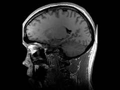 
      
      Study reveals hospitalised COVID-19 patients have low risk of...
      
      