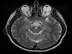 
      
      Scientists observe MRI in order to predict child intelligence
      
      