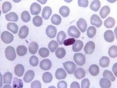 
      
      Study reveals malaria discovery could expedite antiviral...
      
      