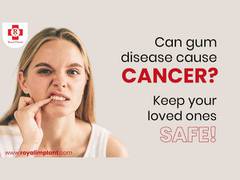 
      
      Be vigilant when it comes to Oral Cancer in India, advises...
      
      