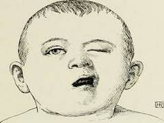 
      
      Researchers develop standardised measurement for pediatric...
      
      