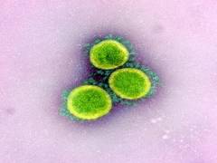 
      
      Woman having COVID-19 symptoms dies in Haridwar
      
      