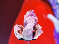 
      
      With great detail, scientists map heart recovery rate after...
      
      