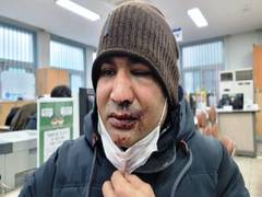 
      
      Pakistan's minority rights activist attacked in S Korea seeks...
      
      