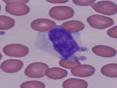 
      
      Study reveals lower levels of lymphocyte blood cells may...
      
      