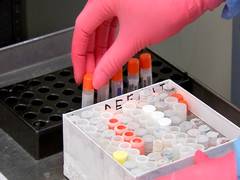 
      
      Study reveals COVID-19 infection rates low in people with...
      
      