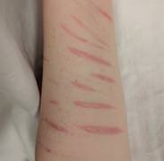
      
      Non-suicidal self-injury is associated with impulsive...
      
      