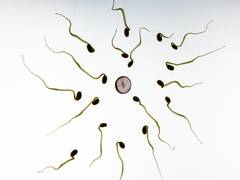 
      
      Damage to sperm DNA can lead to repeat miscarriages
      
      