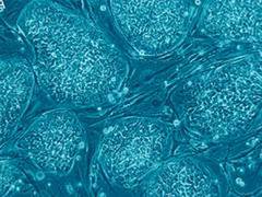 
      
      Discovery finds cellular building block acts as a gel, not...
      
      