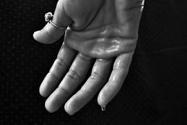 
      
      Scientists develop biosensor bandage to collect and examine sweat
      
      