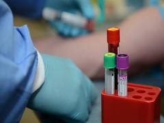 
      
      Blood test may help doctors detect pancreatic cancer, says study
      
      