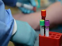 
      
      Russian firm launches production of world's 1st combined HIV,...
      
      