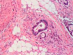 
      
      New AI model helps identify colorectal cancer, predict its...
      
      