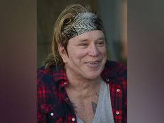 
      
      Mickey Rourke shares gruesome pictures of his forehead injury 
      
      