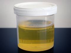 
      
      Five-minute urine test reveals quality of your diet plan: Study 
      
      