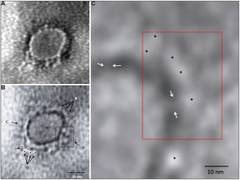 
      
      Indian scientists reveal microscopic image of novel coronavirus
      
      