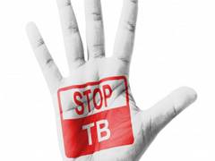 
      
      Researchers find new way that makes tuberculosis suppress...
      
      