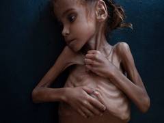 
      
      5 million Yemenis 'one step away from famine' in 2021, UN warns
      
      