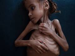 
      
      Madagascar reports 'pockets of famine', risks grow for...
      
      