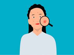 
      
      Study finds skin infections cause of rheumatic fever
      
      