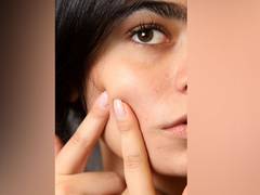 
      
      Do you know daily consumption of sweets and cakes can cause acne?
      
      