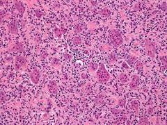 
      
      Cells fight stress with adhesion: Study 
      
      
