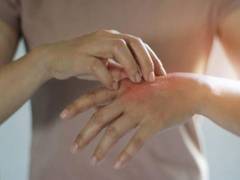
      
      Light therapy helps burn injuries heal faster, study finds
      
      